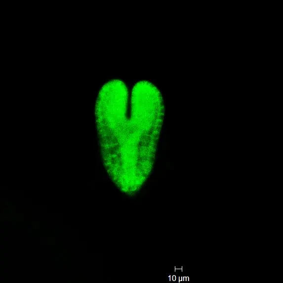 Heart-stage Arabidopsis embryo · AGB1–VEN in agb1-3 · 10 µm