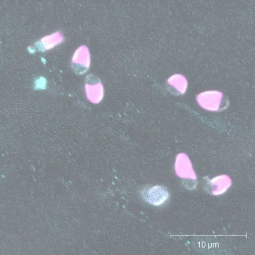 C. merolae autofluorescence, light microscopy · 10 µm
