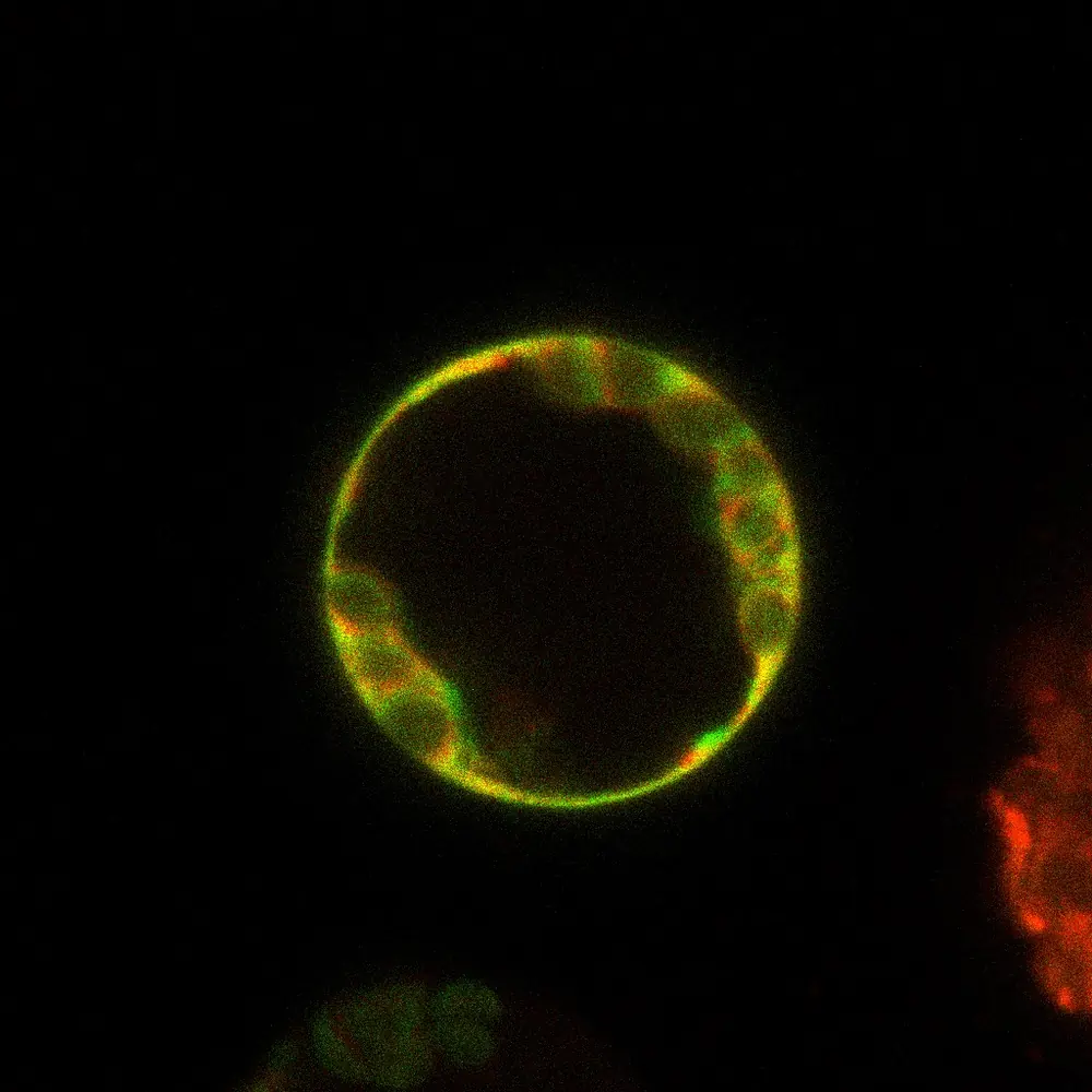 ER pattern in an Arabidopsis protoplast