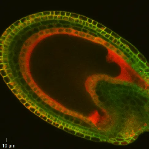 Developing Arabidopsis embryo · 10 µm