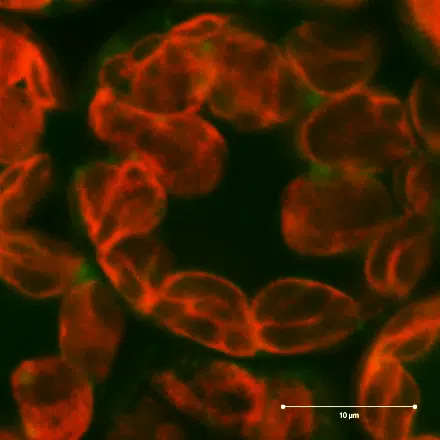 Chlorophyll autofluorescence in Arabidopsis protoplasts · 10 µm